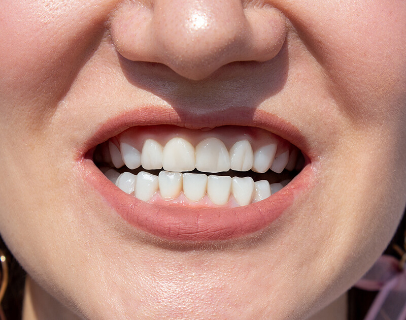 transformation-img-after-5