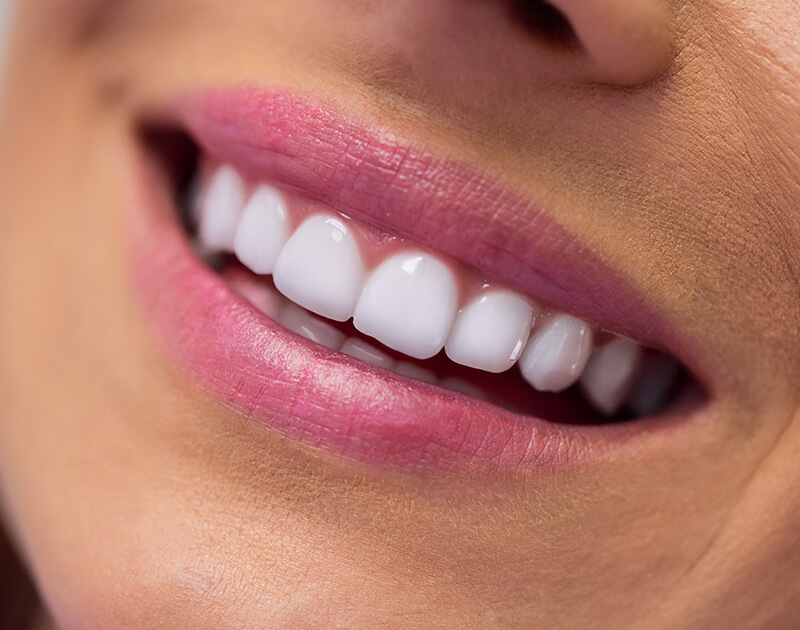 transformation-img-after-9