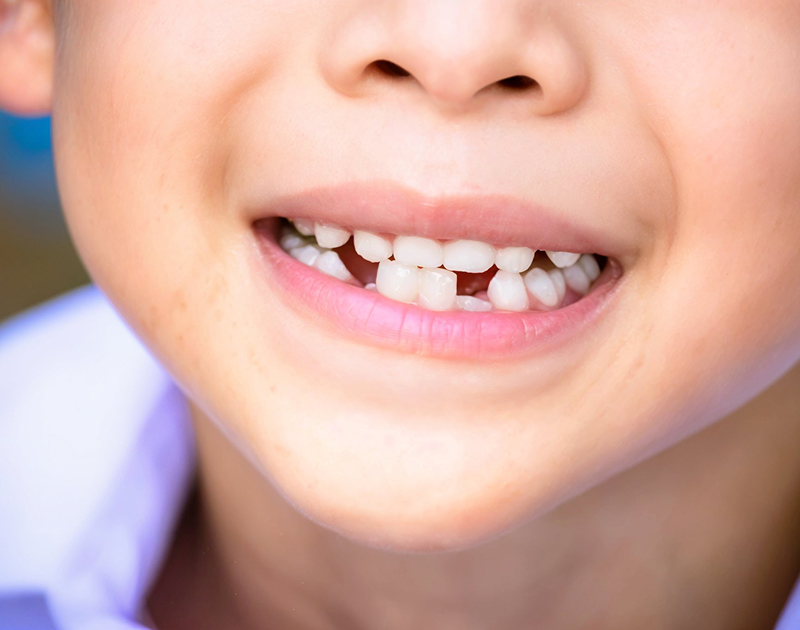 transformation-img-before-1