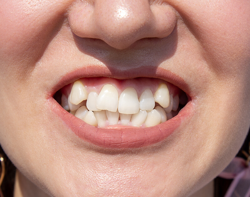 transformation-img-before-5